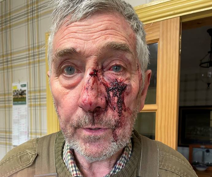 Victim Alan Cummings