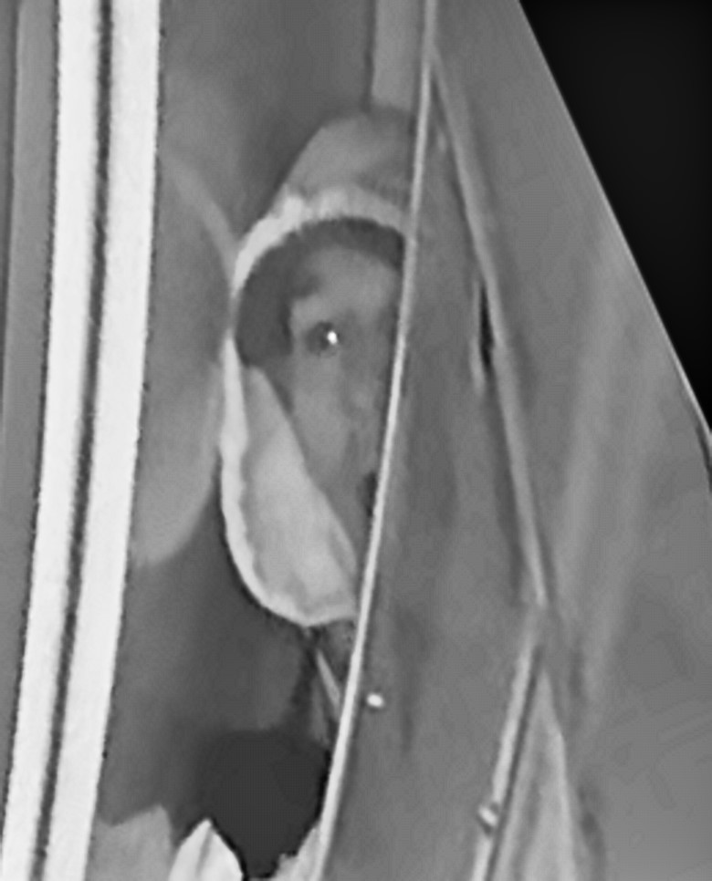 cctv